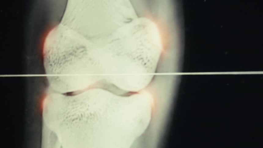The monitor displays an x ray of a knee