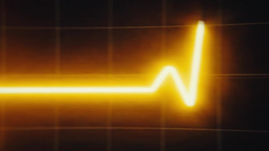 Bright yellow electrocardiogram line on a dark background