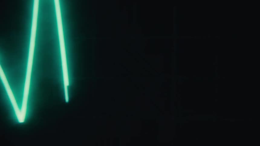 Cardiac event monitor machine displaying a green heart rate line moving from left to right on a dark screen