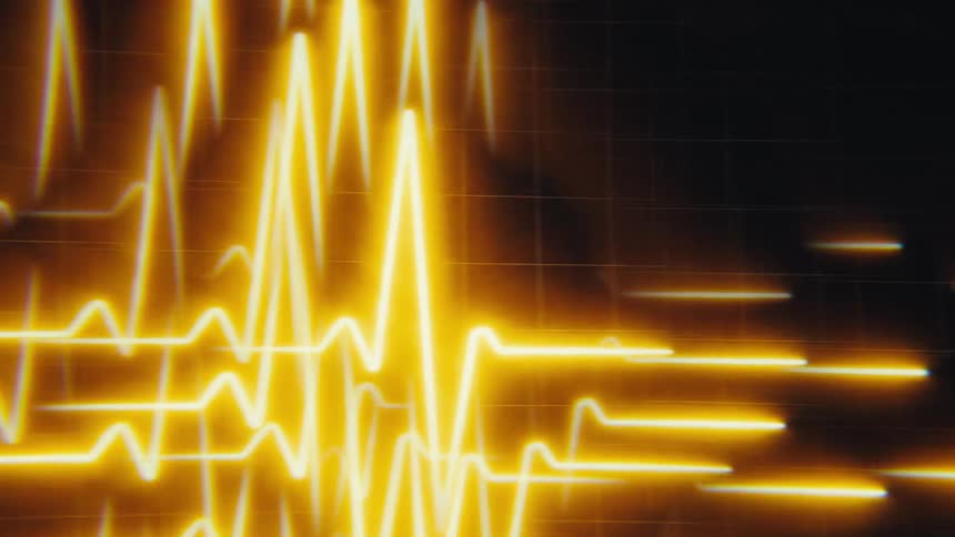 A dark video shows bright orange yellow line graphs moving in a rhythmic and digital pattern on a grid