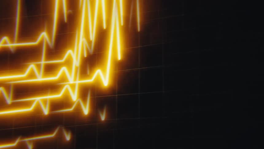 Electrocardiogram lines in bright yellow tones on a dark background