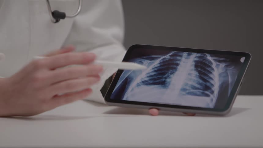 A person in a lab coat hold a tablet with an xray on the screen and points at the screen with a stylus pen