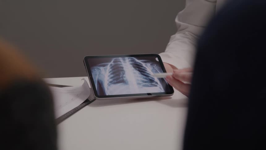 Doctor shows chest xray on a tablet to the patient