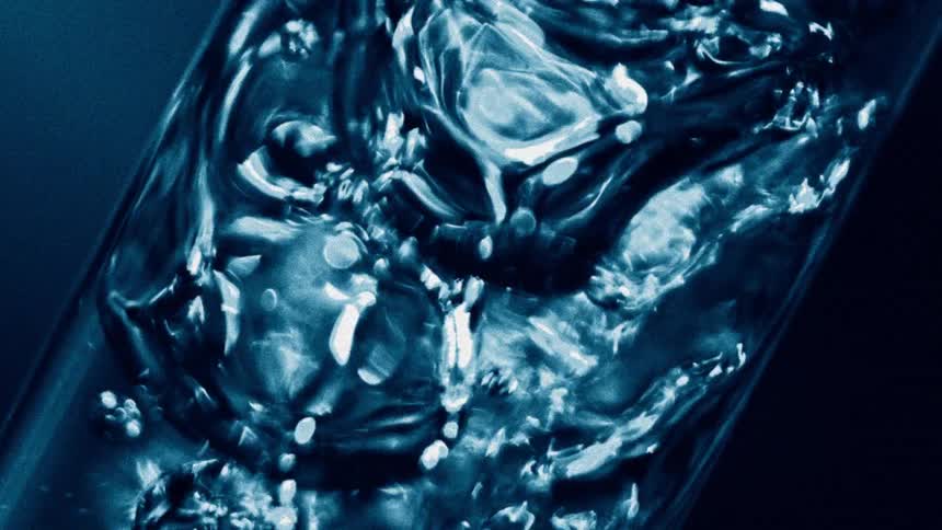 Air bubbles rise in blue liquid forming organic glistening shapes