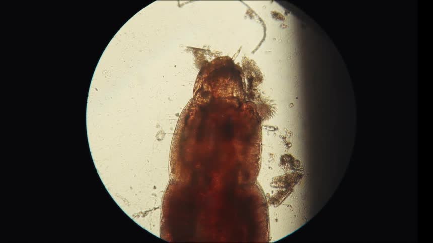 A reddish mitelike organism viewed under a microscopes circular field