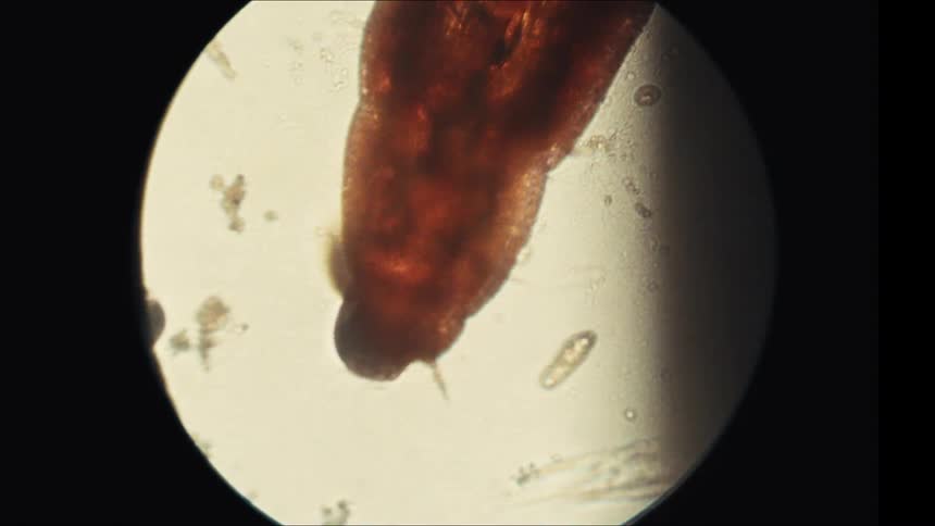 Close up of a moving organism under microscopic lens
