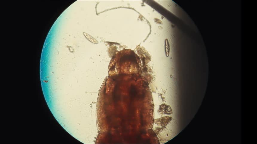 Close up of multiple organisms moving under microscopic lens