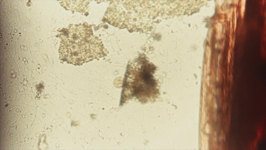 A microscopic view shows clumps of brown particulate matter and oblong microorganisms floating and slowly moving across a light tan or beige liquid background
