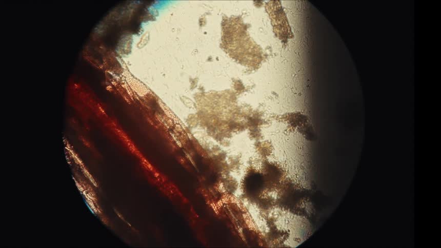 Microscopic animal moves through a magnified microscopic image