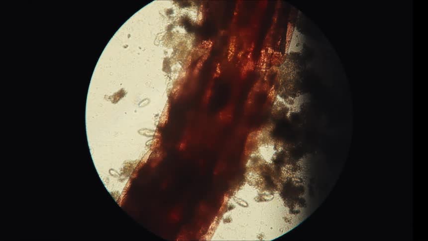 Organisms seen under a microscope