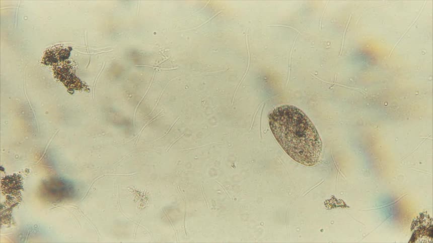 A single celled organism