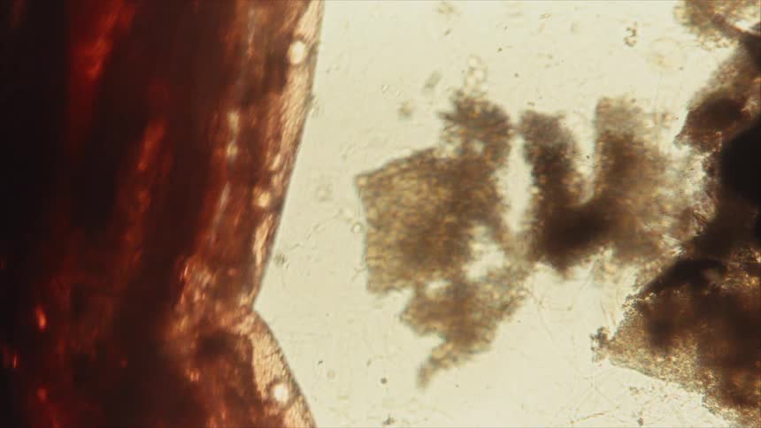 A microscope view shows a large dark orange fibrous organic structure with smaller lighter brown organisms moving across a pale tan background