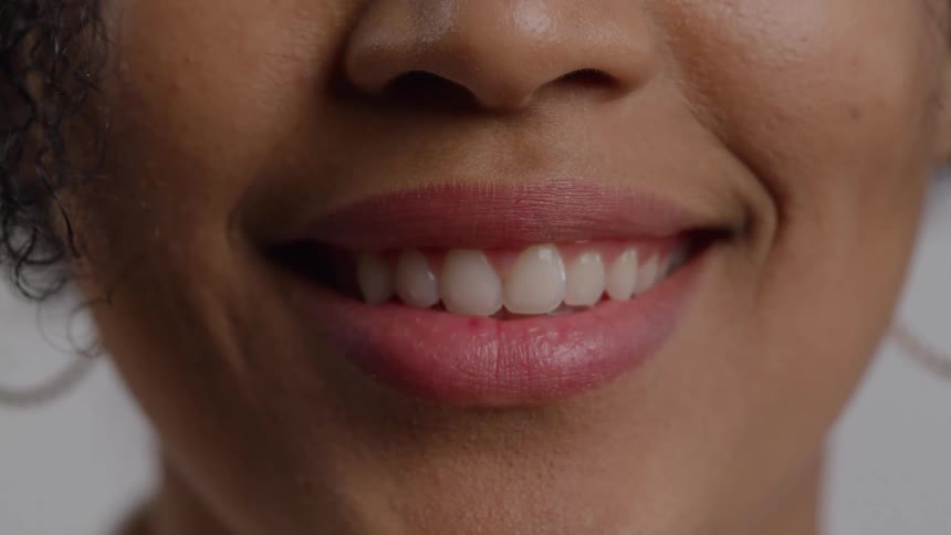 Woman smiles revealing even teeth