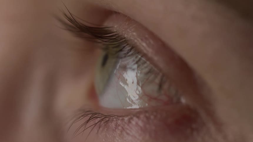 Person opens their eye and stares