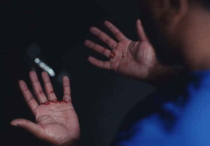 The mans hands are bleeding from lifting weights