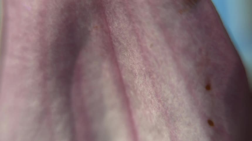 A close view of detailed skin texture showing large parallel stretch marks and small dark spots under bright light in an abstract macro shot