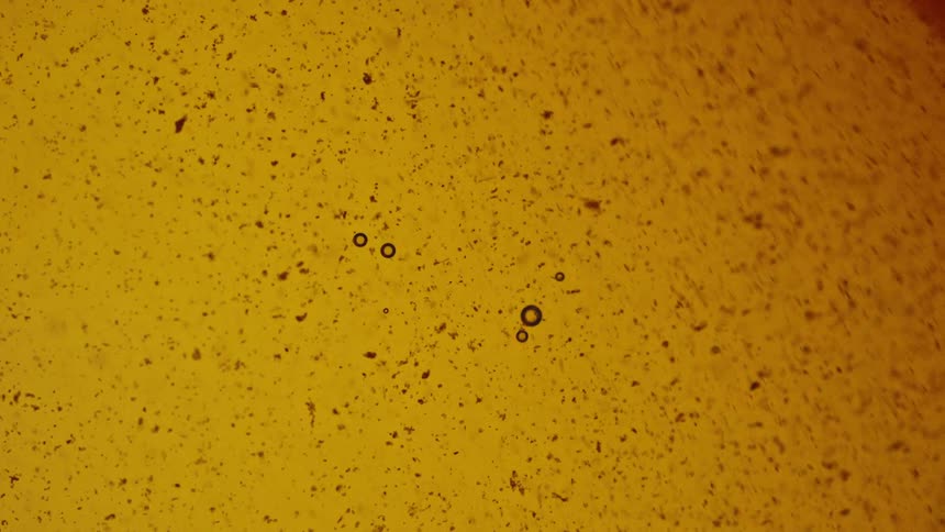 An extremely closeup view of a dark speckled yelloworange fluid with small air bubbles