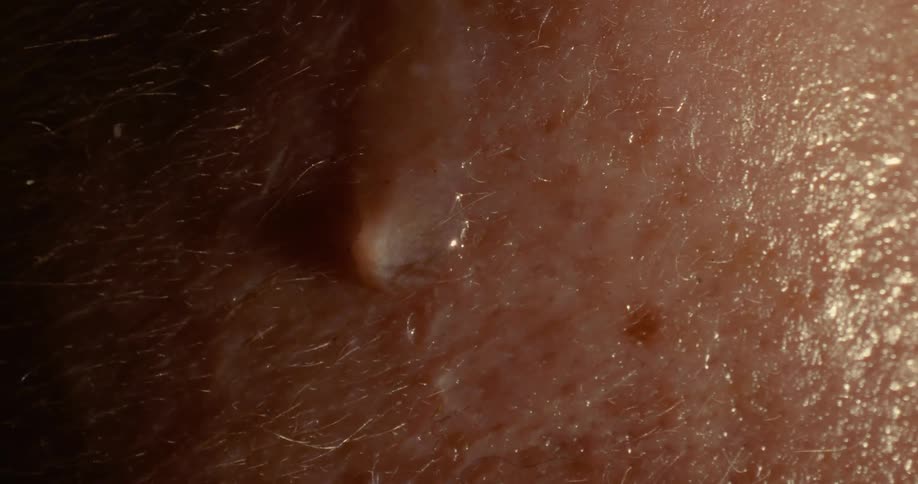 A single bead of sweat rolls down textured human skin