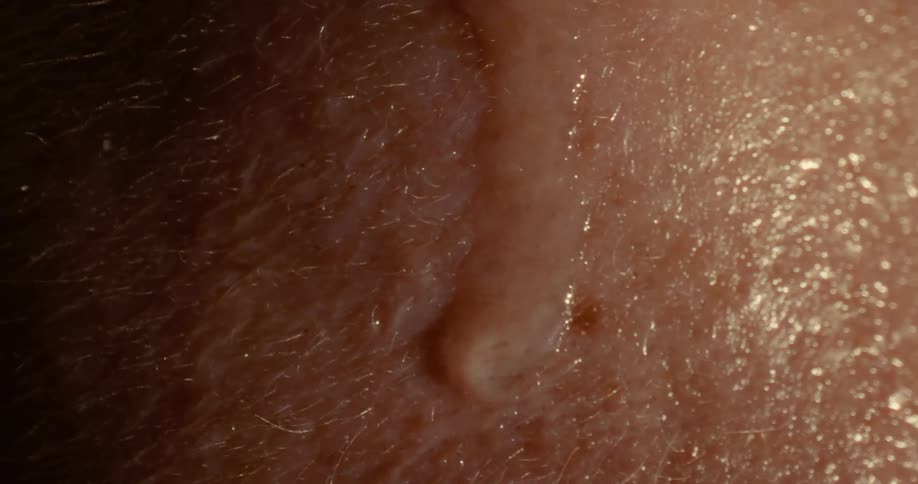 Bead of sweat running down the skin