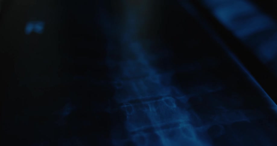 Blue xray shows topdown view of spine