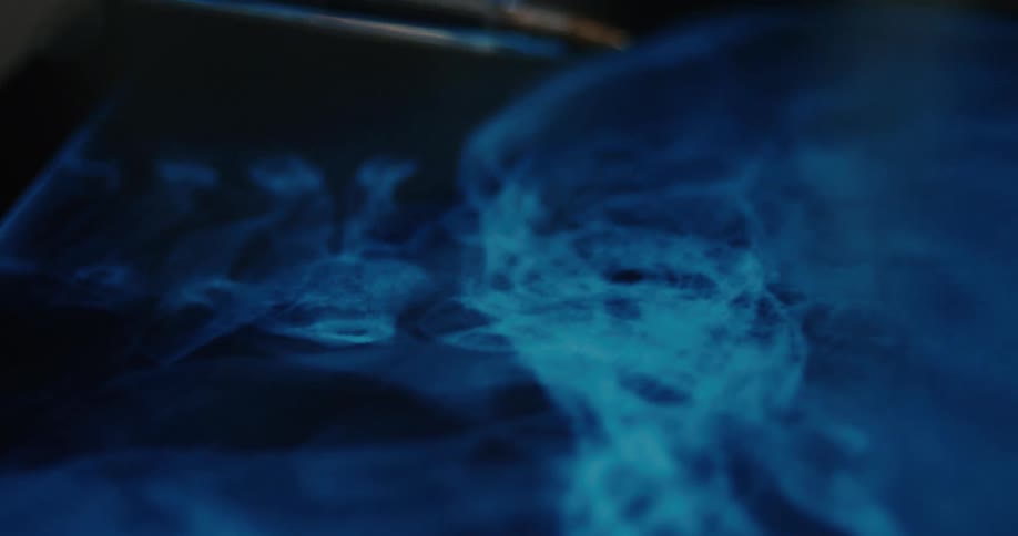 Skull xray with a pen tip pointing to a specific area