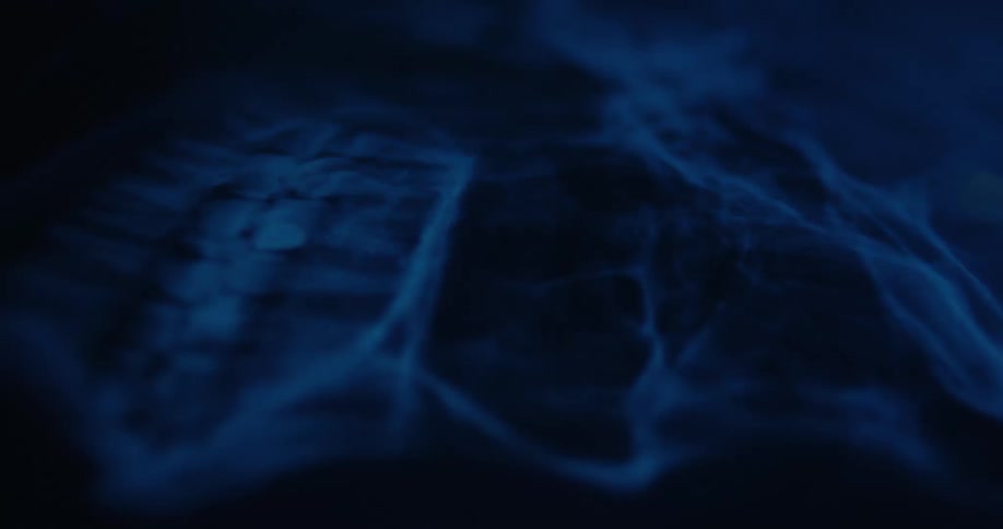 Bluetoned xray showing bone details in a close view