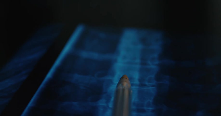 Pen on a ct scan