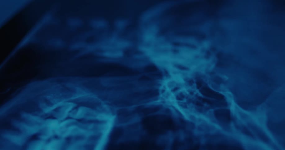 Bluetoned xray displaying internal structures in close detail