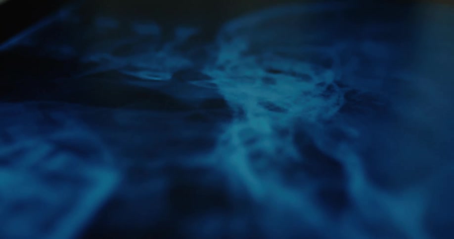 Medical scan image showing internal structures in blue tones