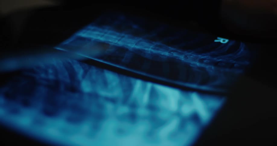 The hand with holding the pen is pointing to an xray in a dark room