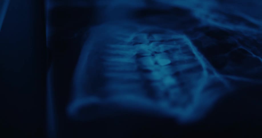 Pale tendrils cover a dental film in a dimly lit area