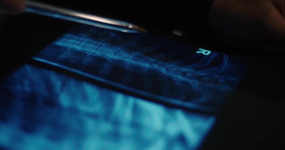 A medical practitioner uses a pen to examine a ct scan inside a dark room