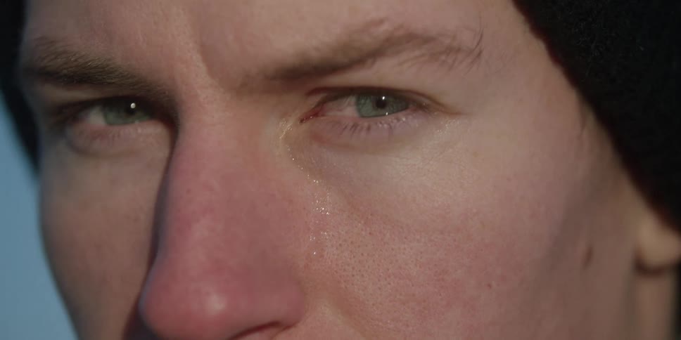 Closeup of a face with lightcolored eyes dark beanie and slightly reddened skin