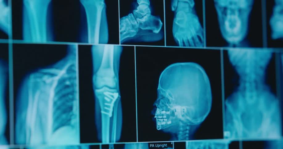 The monitor has many x rays of many different parts of the body
