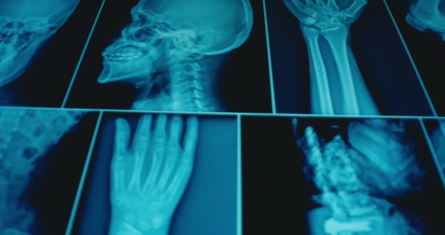 A clsoe up of some x rays