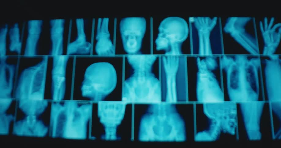 Xray images display skulls limb bones and torso arranged in a grid