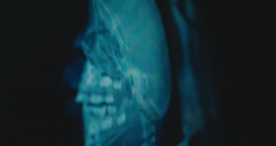 The camera pans across a glowing blue monitor displaying various medical xrays moving from a closeup of a rib cage and skull to a detailed view of a human pelvis and spinal column