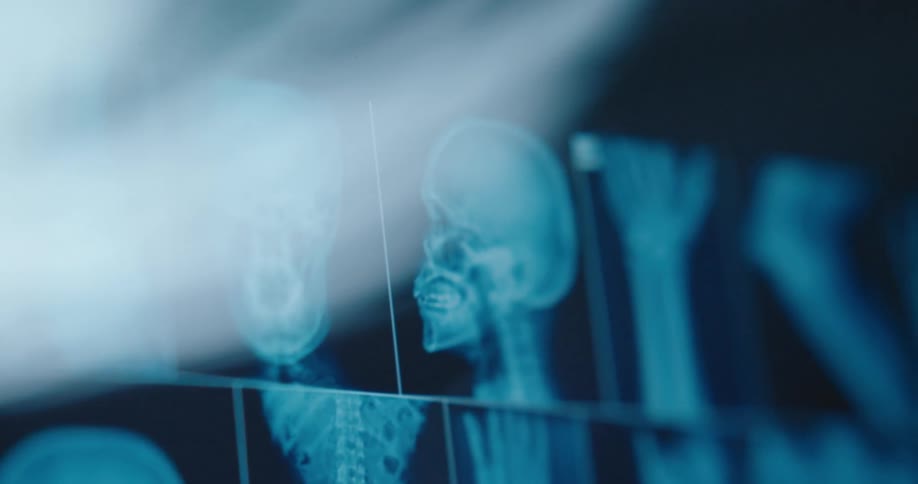 An xray scan of a human body displayed on a screen showing the skull arms and other skeletal structures for examination