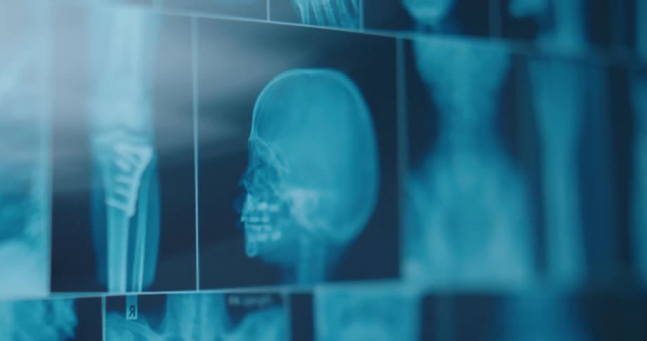 A digital display monitors multiple bluetinted medical xray scans including a profile view of a human skull a spinal column and a knee joint with surgical hardware