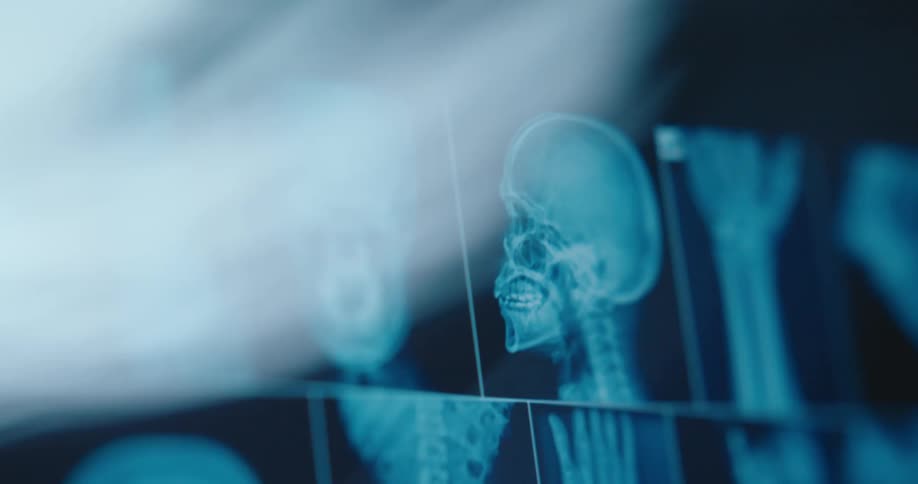 The screen is full of medical scans of a person