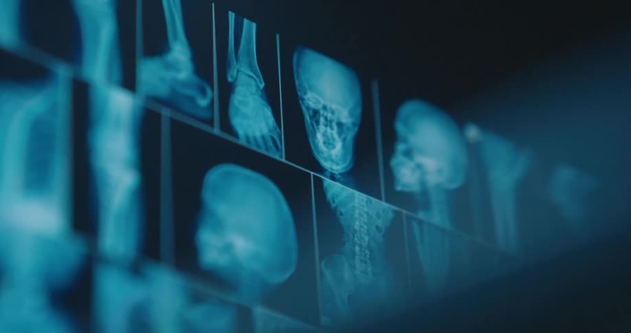 A view of an x ray on a screen