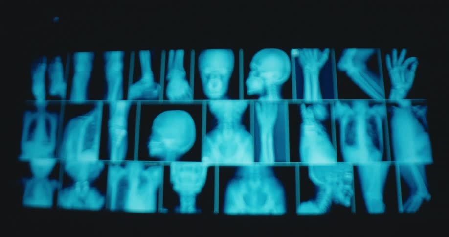 Some digital xray scans on a screen