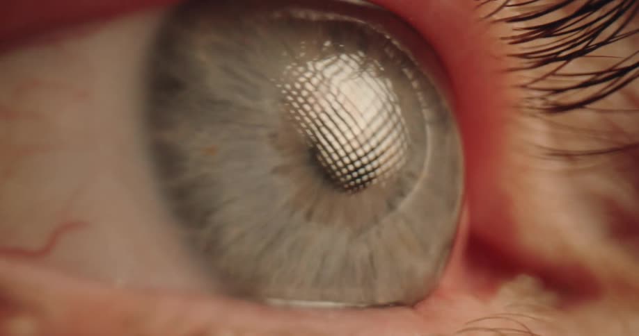 Light reflects on the persons eye