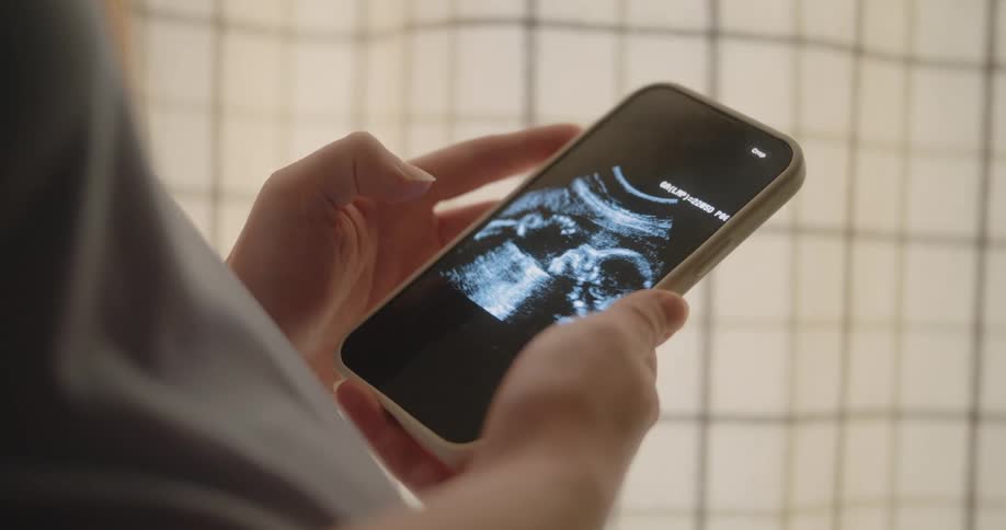 The person looks at a sonogram picture on their phone