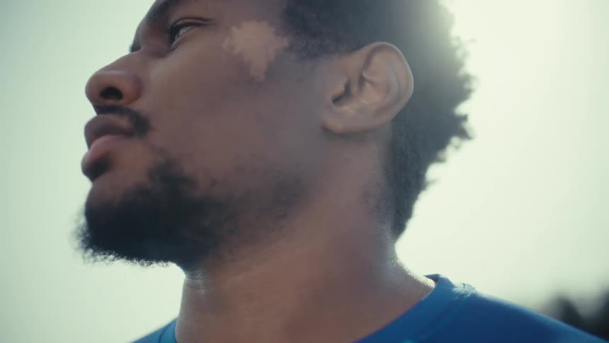 Man in profile wearing blue shirt shows facial skin tone variation