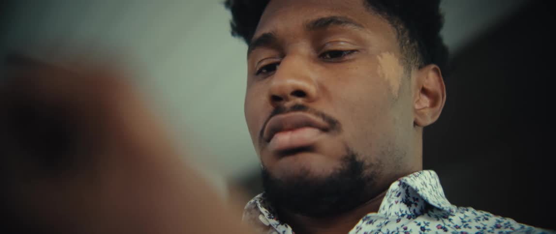 The video shows a closeup of a man with vitiligo on his cheek looking down at a smartphone he appears to be focused and serious while interacting with the device