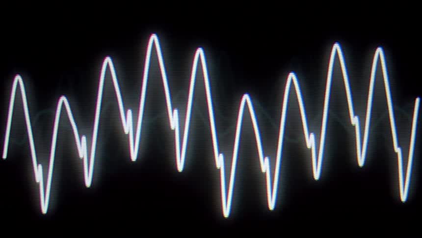 The line on the cardiograph is jumping fast