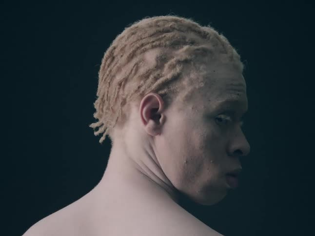 Profile of a black albino man indoors