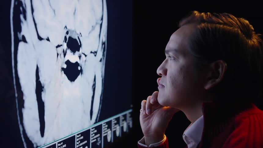 A man in a red sweater and white collared shirt looks closely at a large monitor displaying a black and white medical scan of a human head