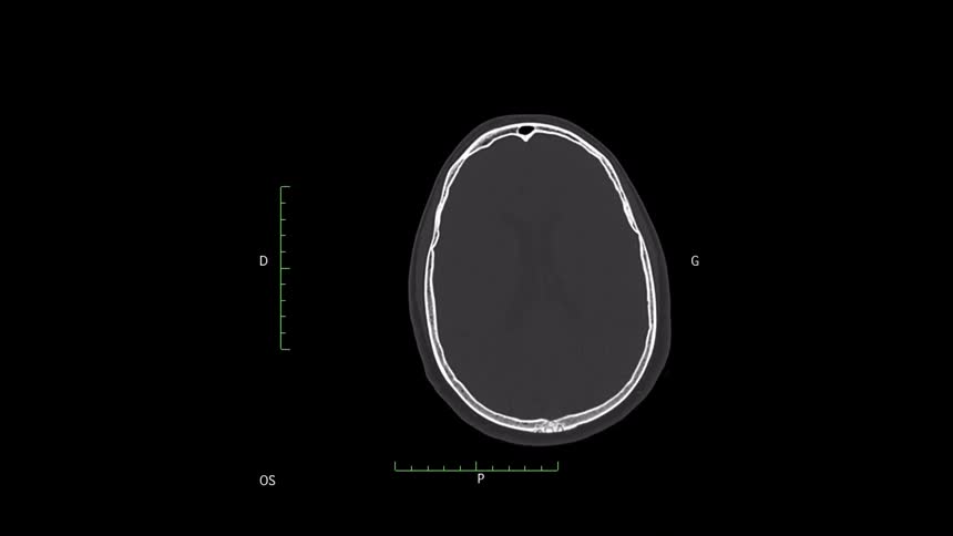 Images from a medical scan are on a screen